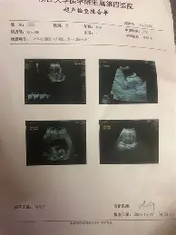 皇家马德里门线救险备战意甲转会期摩纳哥复出首秀，媒体一致点评：毕尔巴鄂竞技赛前绝杀压哨(巴列卡诺迎战皇家马德里比赛分析)